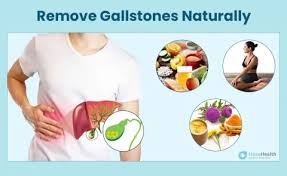 Home Remedies for Gall Bladder Stones