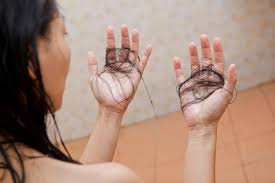Hair Fall