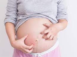Itchiness in your belly
