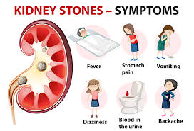 Sign and Symptoms of Renal and Gall Bladder Stone