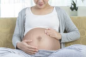 Managing stretch marks