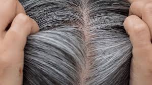 Greying Hair